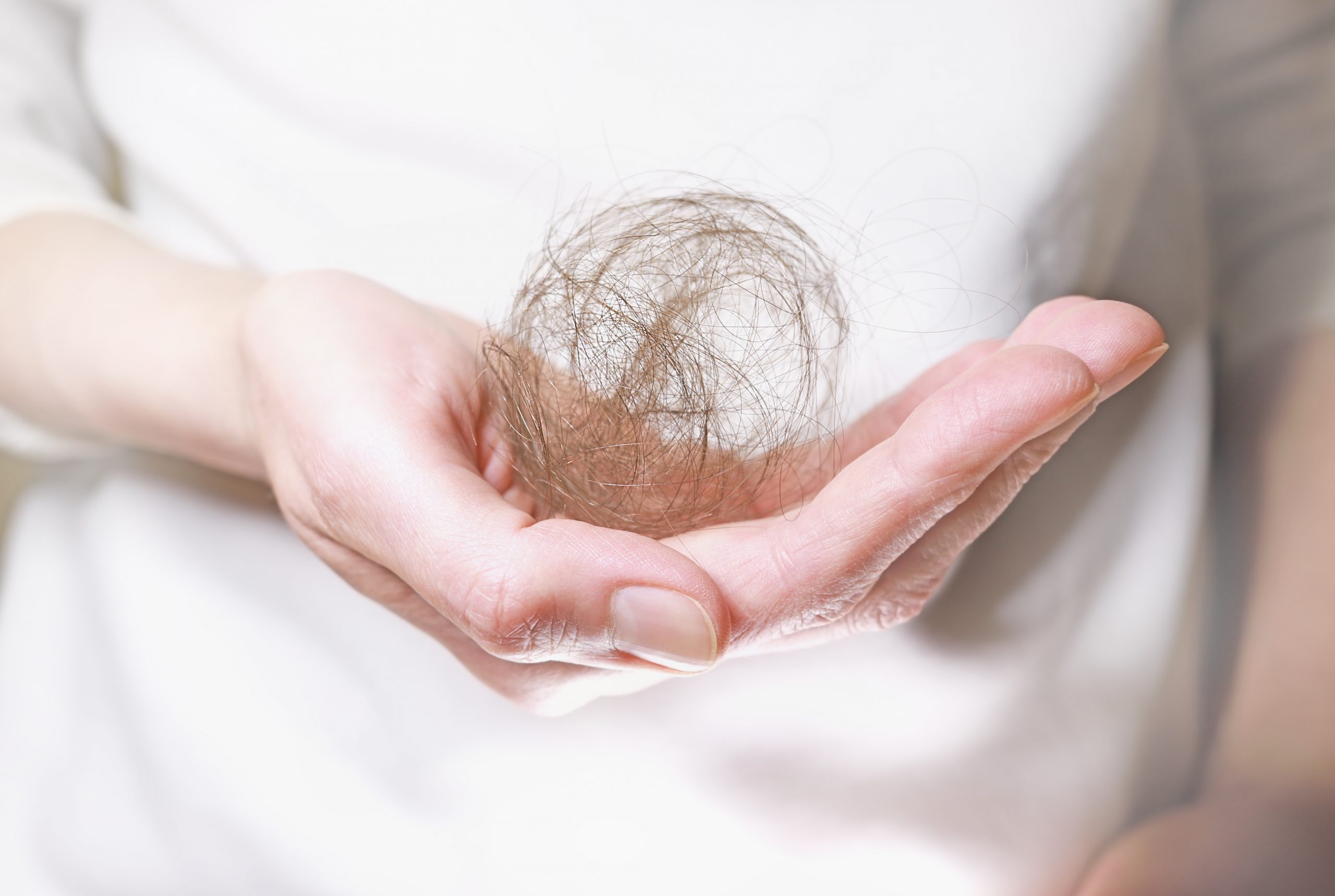 How to manage hair loss due to alopecia